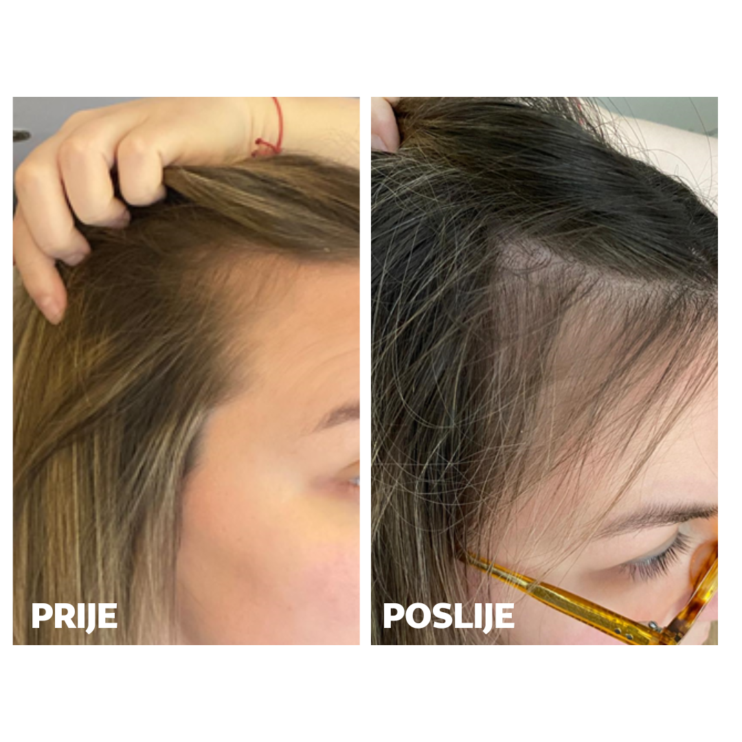 Skinage HAIR Strong 60a capsules