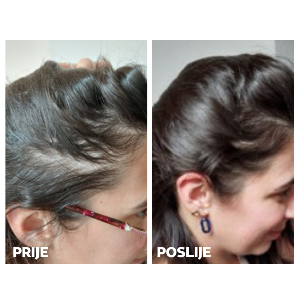 Skinage HAIR Strong 60a capsules