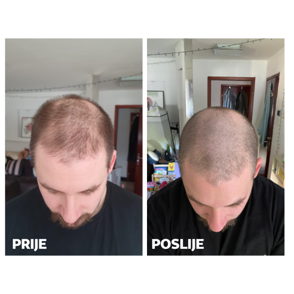 Skinage HAIR Strong MEN 60s Capsules SET