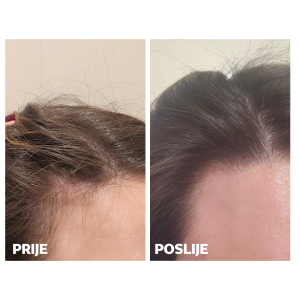 Skinage HAIR Strong 60a capsules