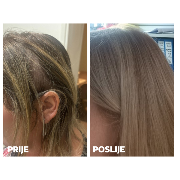 Skinage HAIR Strong 60a capsules